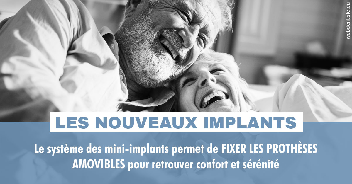 https://dr-grenard-annabelle.chirurgiens-dentistes.fr/Les nouveaux implants 2