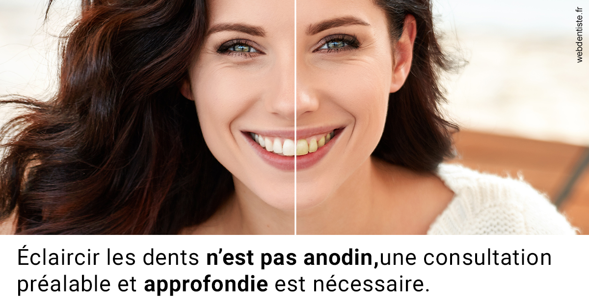 https://dr-grenard-annabelle.chirurgiens-dentistes.fr/Le blanchiment 2