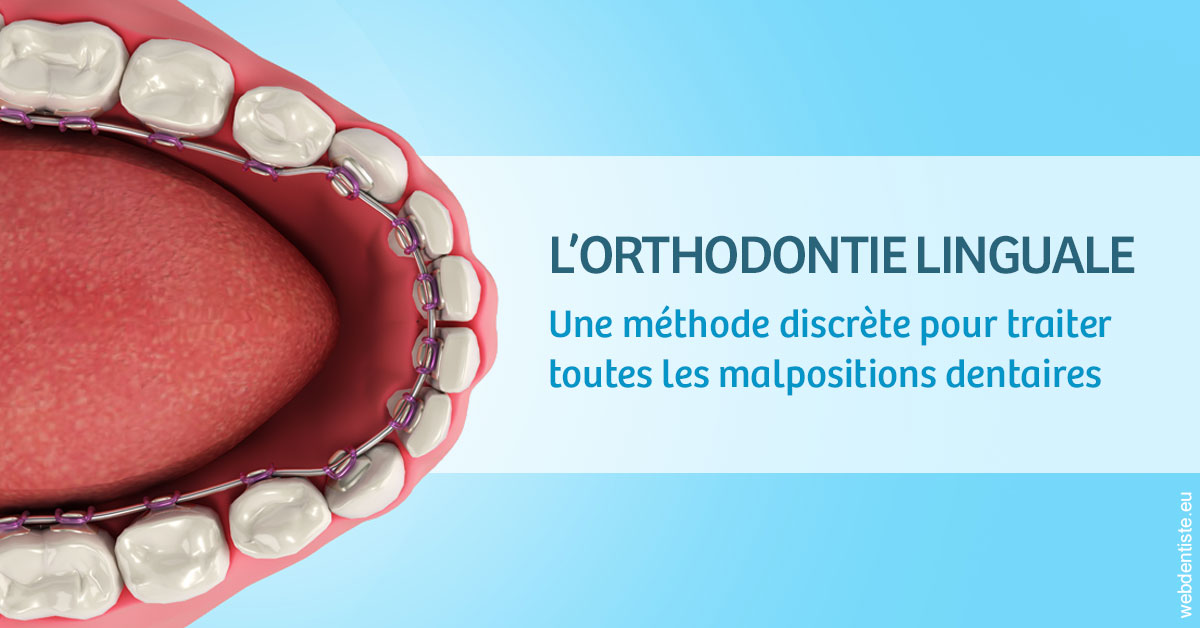 https://dr-grenard-annabelle.chirurgiens-dentistes.fr/L'orthodontie linguale 1