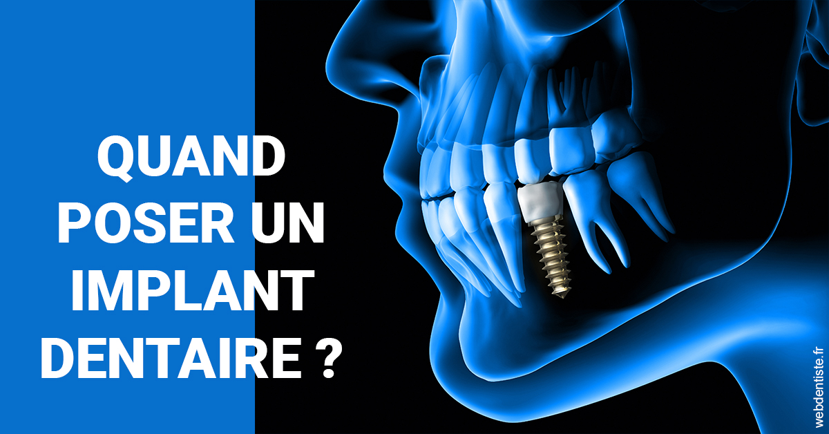 https://dr-grenard-annabelle.chirurgiens-dentistes.fr/Les implants 1