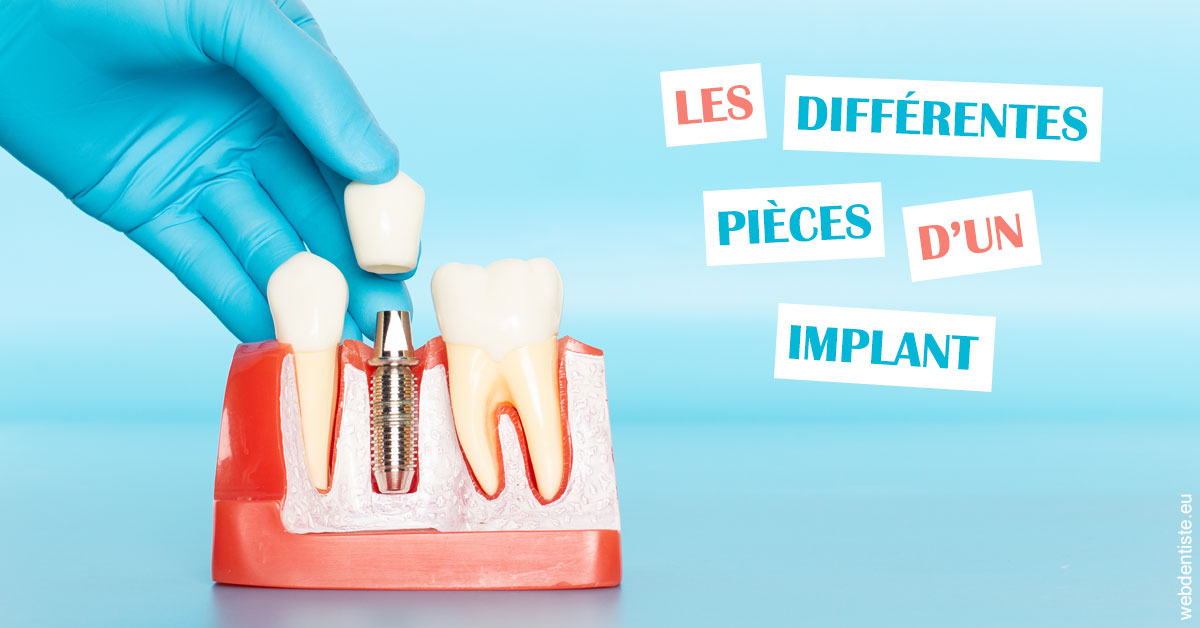 https://dr-grenard-annabelle.chirurgiens-dentistes.fr/Les différentes pièces d’un implant 2