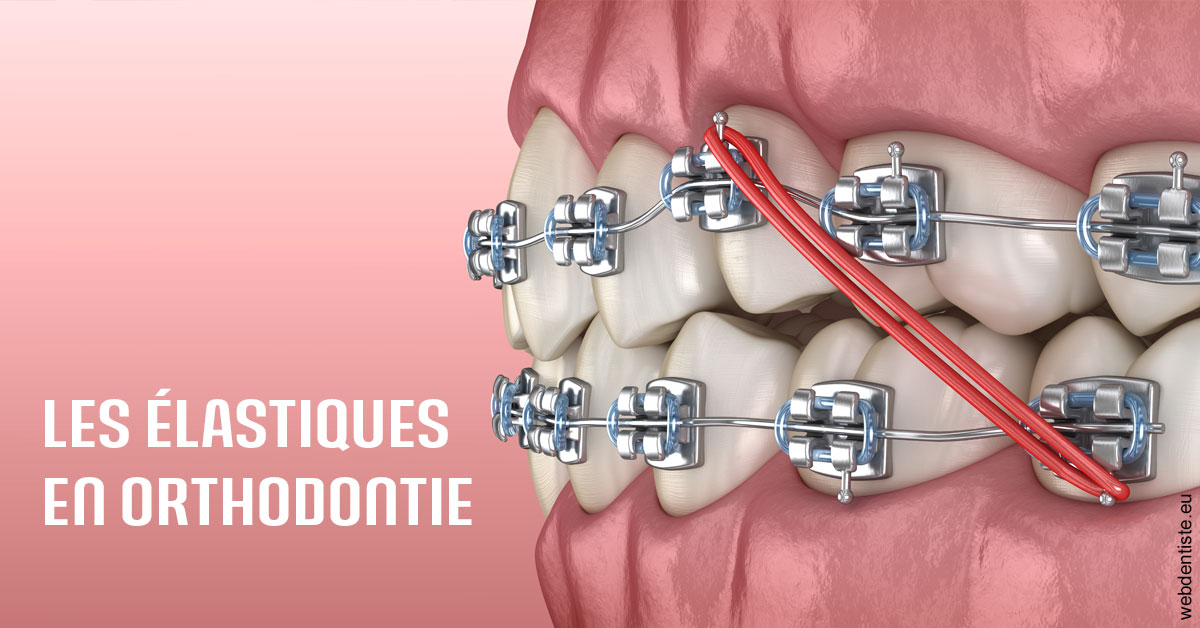 https://dr-grenard-annabelle.chirurgiens-dentistes.fr/Elastiques orthodontie 2