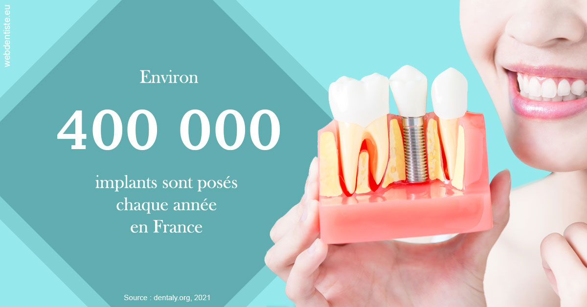 https://dr-grenard-annabelle.chirurgiens-dentistes.fr/Pose d'implants en France 2